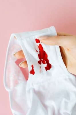 After Giving Birth Bleeding