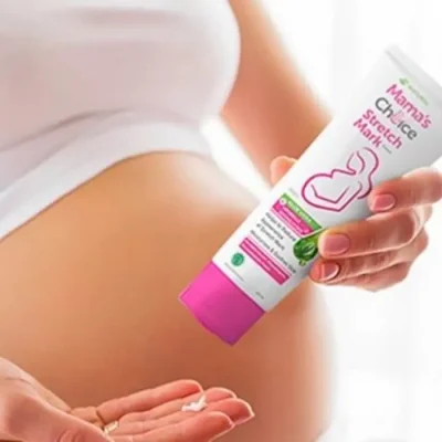 Mama's Choice Stretch Mark Cream